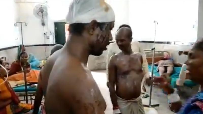 बिहार: छेड़छाड़ के विरोध पर परिवार के 16 लोगों पर तेज़ाब फेंका