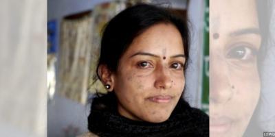 Leprosy Is Making A Comeback In India But The Govt Wants To Deny It