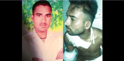 Akhlaq, before (left) and after the attack on him. Photos: By arrangement