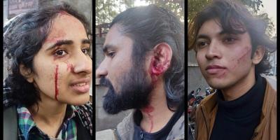 Injured members of Campaign Against State Repression. Photos: Special arrangement