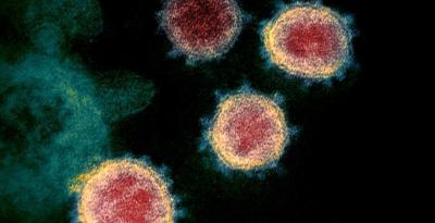 This undated transmission electron microscope image shows SARS-CoV-2, also known as novel coronavirus, the virus that causes COVID-19, isolated from a patient in the US. Photo: NIAID-RML/Handout via Reuters