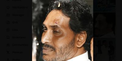 Andhra Pradesh chief minister Y.S. Jaganmohan Reddy was injured in an alleged attack during a political rally in Vijayawada. Photo: X/@YSRCParty